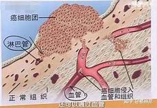 种植牙修复过程我国20岁到39岁的中青年群体是接受种植牙手术的