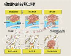 中国糖尿病网建议加强公共政策与立法